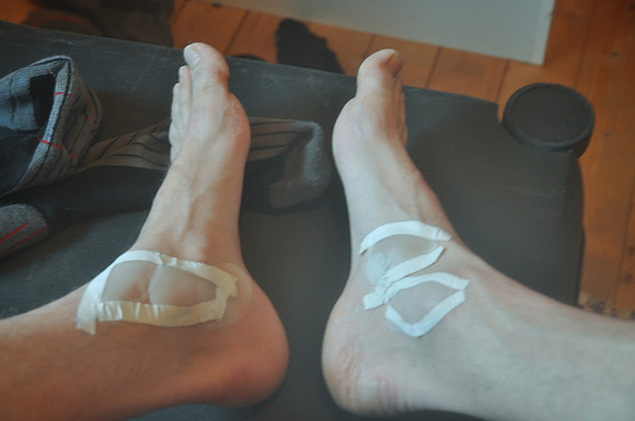 Les pieds souffrent après 2 jours - Svensby - Norway